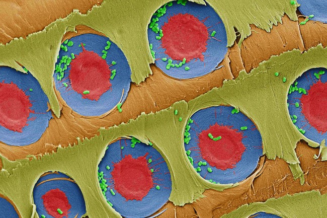 MIT Researchers Discover Sapwood  is Inexpensive Water Filtration Method